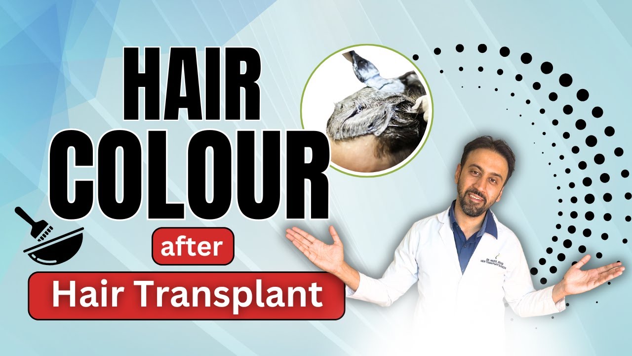Can you do Hair Colour/Dye After Hair Transplant? क्या Hair Transplant के बाद Hair Dye कर सकते है?