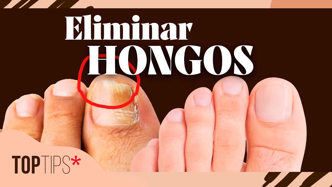 Cómo blanquear las uñas de los pies en 7 pasos