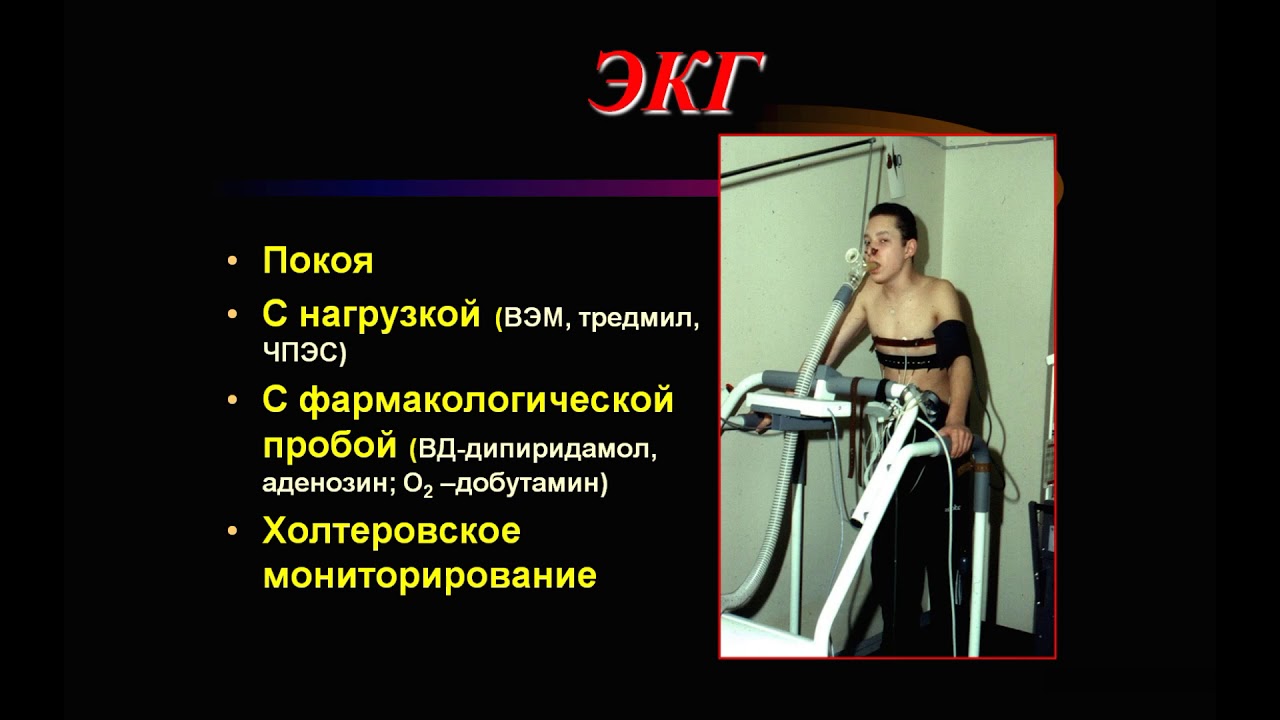 Лекция: Синдрома коронарной недостаточности