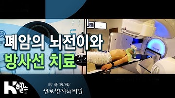 폐암의 뇌전이와 방사선 치료 - 폐암, 속도전으로 맞서라 (KBS_746회_2020.09.23)