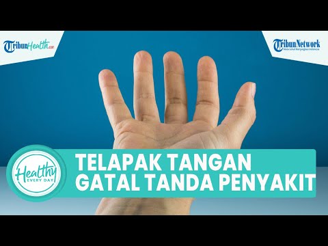 Video: Apa artinya jika tanganmu bengkak?
