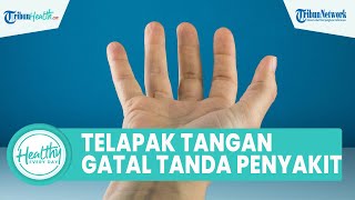 Waspadai Telapak Tangan Gatal Bisa Jadi Tanda Penyakit Serius: Eksim hingga Diabetes Mellitus