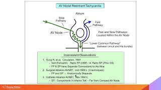 Complex Cases Simplified:  AVNRT Part I with Warren 'Sonny' Jackman, MD