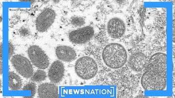 Monkeypox: What CDC