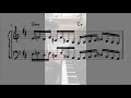 Anomalie upright jam transcription