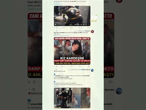 مشهد من الجحيم تركي يسكب الماء المغلي على رأس شقيقته