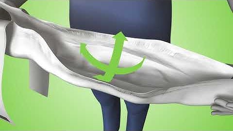 How to apply TENA Flex standing | TENA Professional