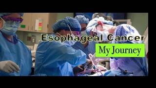 Esophageal Cancer My Journey #2