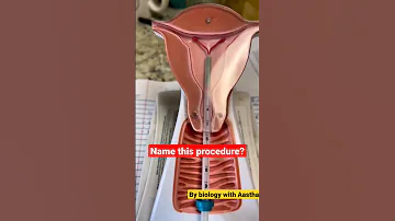 Shorts Short Shortsvideo Viralshorts Neet Aiims Biology Physicswallah Iud Mbbs Doctor 