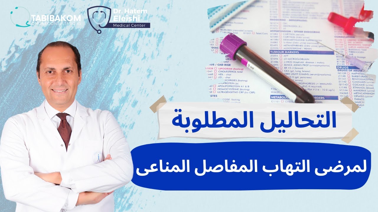 التحاليل المطلوبة لمرضى التهاب المفاصل المناعى.أ.د.حاتم العيشي