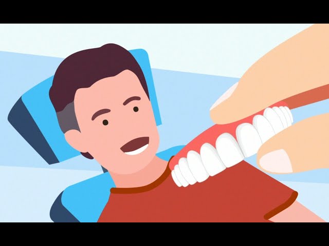 Nowe Zęby w Jeden Dzień ⭐️⭐️⭐️ - Jak Przebiega Zabieg?