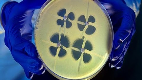 Superbug Scare, 2 Dead 179 Exposed at UCLA Medical Center