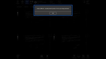 Venue™ Family R3 Tutorial - B-Mode