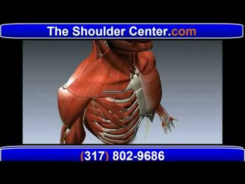 Shoulder Pain - All About  Tendonitis, Frozen Shoulder, Bursitis, and Rotator Cuff Tear