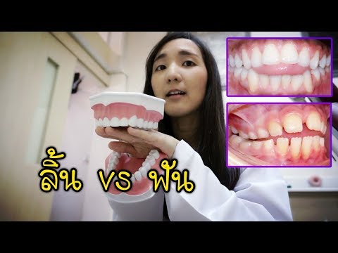 ฟันเหยิน ฟันห่าง จากการกลืนน้ำลาย ??? ll Bow Dent MU
