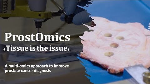 ProstOmics: "Tissue is the Issue" - a multi-omics approach to improve prostate cancer diagnosis