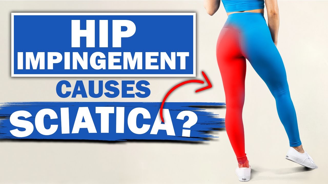 Sciatica Physical Therapy - Treatment & Exercises For Sciatica & Sciatic  Pain | BreakThrough PT