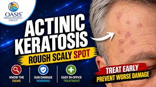 Actinic Keratosis: The “Sun Spot” That Could Turn Into Skin Cancer Dermatologist Explains Actinic Keratoses Early Signs And Treatment