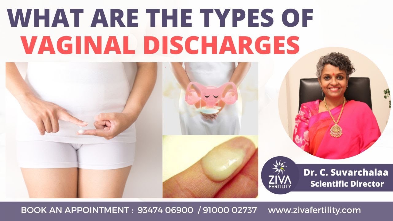 4 Types of Vaginal Discharge That Call for a Trip to the Doctor - South  Avenue Women's Services