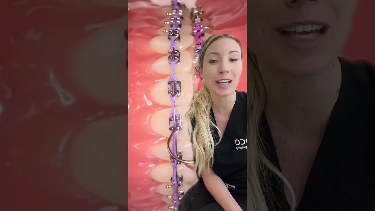 Braces adjustment appointment. 