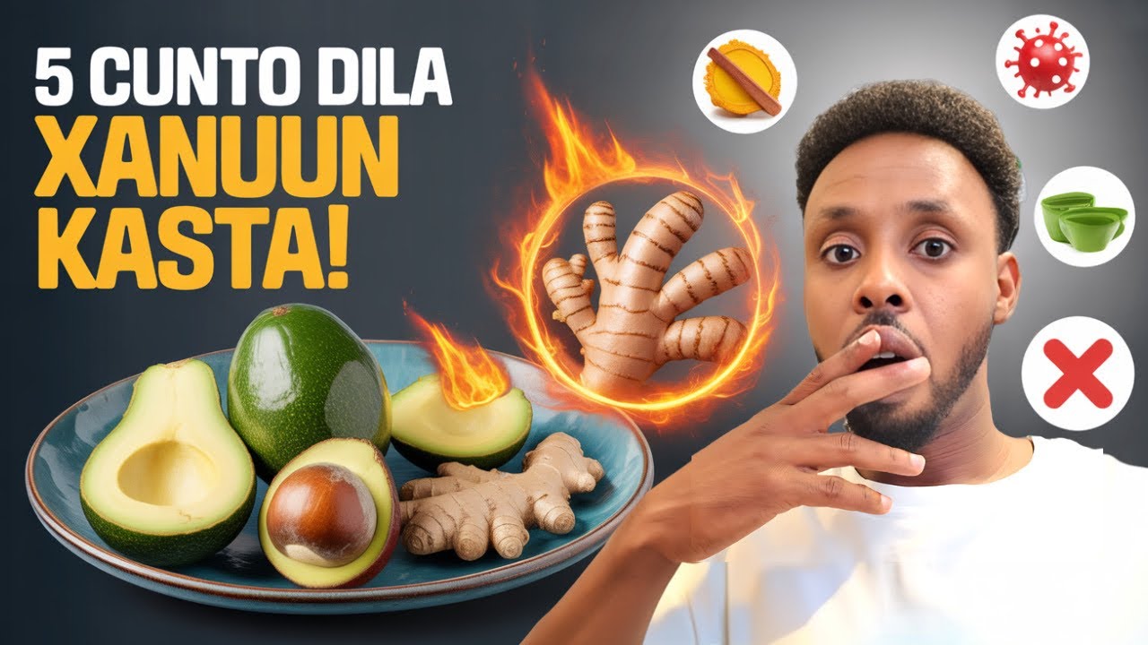 5 Cunto Oo Dila Baruurta & Cudurrada (Qarsoodiga Ah!)