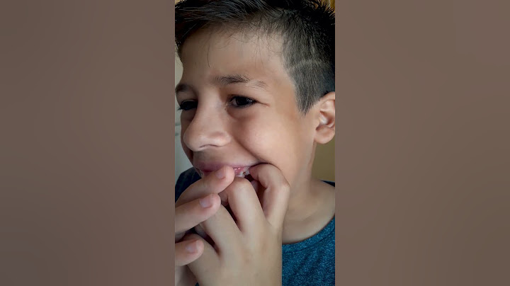 🦷 Olliver Arrancou Dente na Unha
