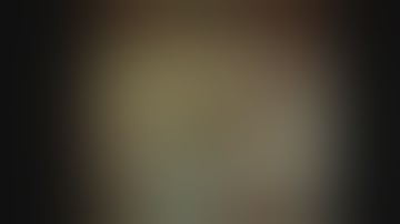 Cholangioscopy-guided double-guidewire technique for complex malignant hilar obstruction