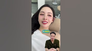 Răng thỏ nhẹ nhàng – dịu mà cuốn #drThu #BsThu #Dansuthammy #Veneer