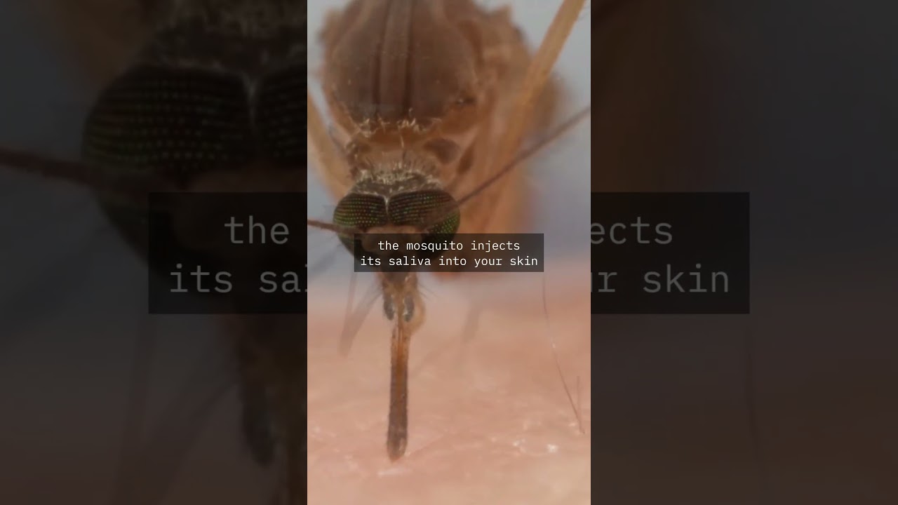 Watch how a MOSQUITO BITES YOU!! 