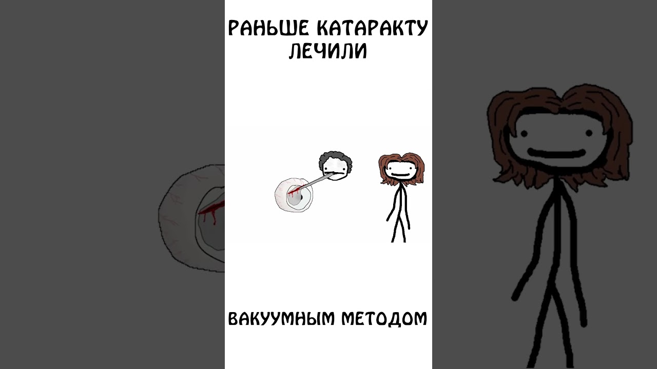 Раньше катаракту лечили вакуумным методом #катаракта #сэмонелла #авызналиэто