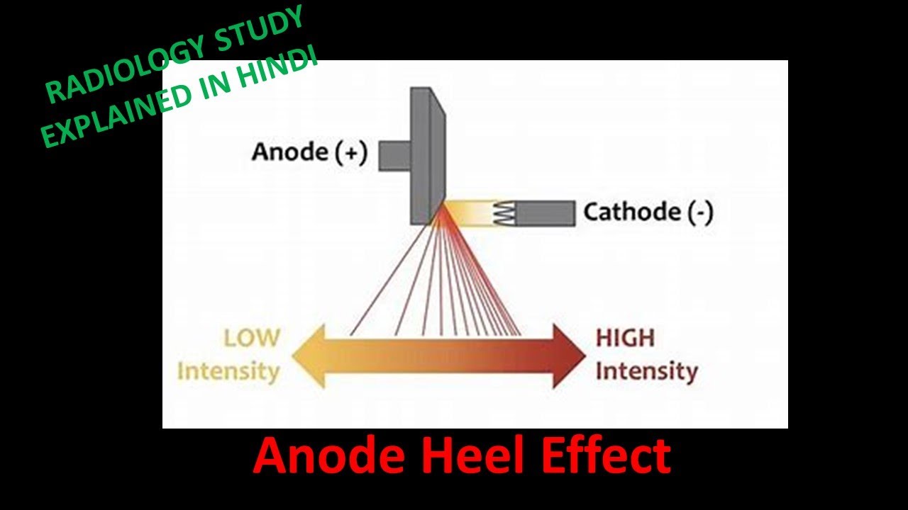 The Anode Heel Effect Assignment Example | Topics and Well Written Essays -  4000 words