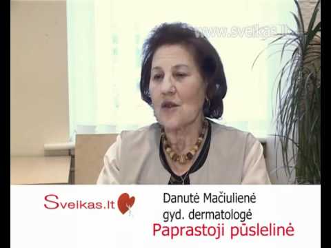 Video: Juostinė Pūslelinė: Simptomai Su Paveikslėliais