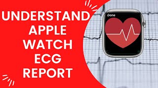 How to understand ECG Report from your Apple watch