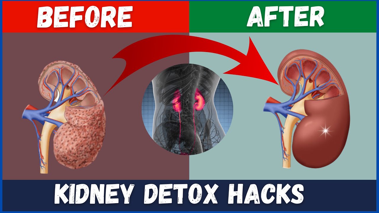 Top 10 Foods to Detox Your Kidneys - YouTube