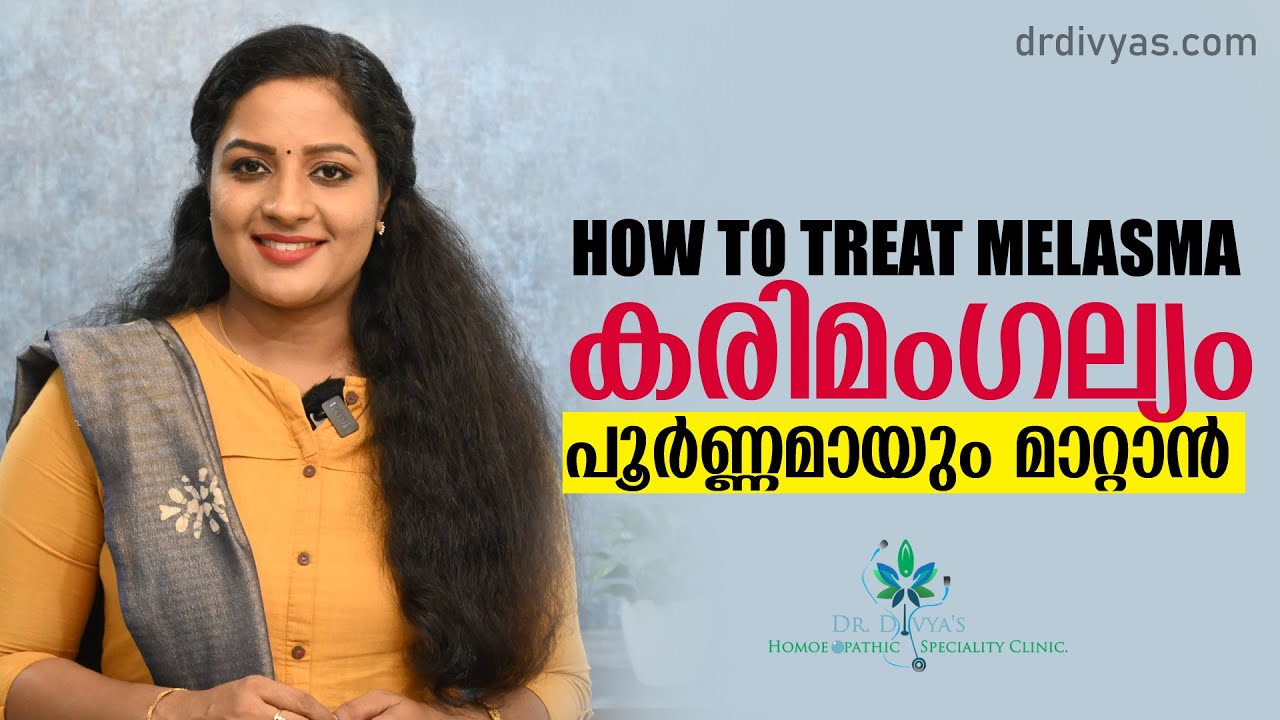 കരിമംഗല്യം പൂർണ്ണമായും മാറ്റാൻ | How To Treat MELASMA | Dark Spots |  HYPER PIGMENTATION On Face
