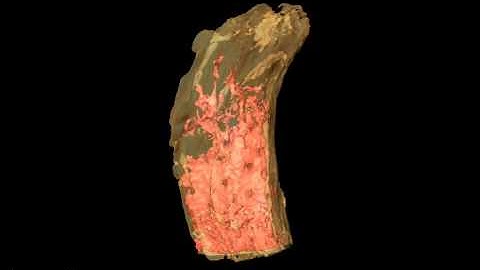 Three-dimensional tomographic reconstruction of lacuna from mouse tibia trabecula