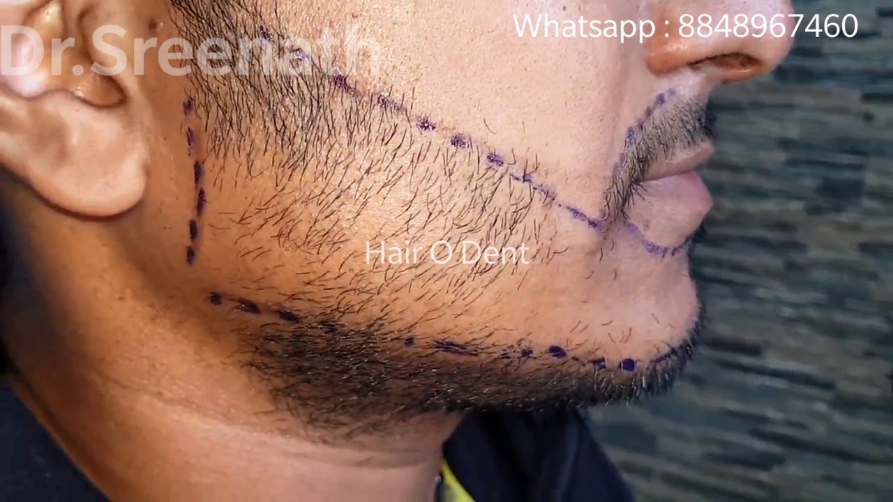 Ramesh Pisharody  Karikku Team  Jis Joy  Hair O Dent Kochi Clinic  Inauguration  YouTube