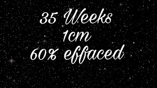 35 weeks, 1cm, 60% effaced