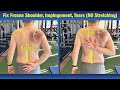 Incredible way to fix frozen shoulder  impingement  no stretching or pt exercises