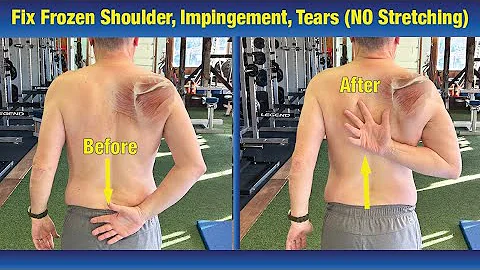 INCREDIBLE way to Fix Frozen Shoulder & Impingement - (NO Stretching or PT Exercises) - DayDayNews