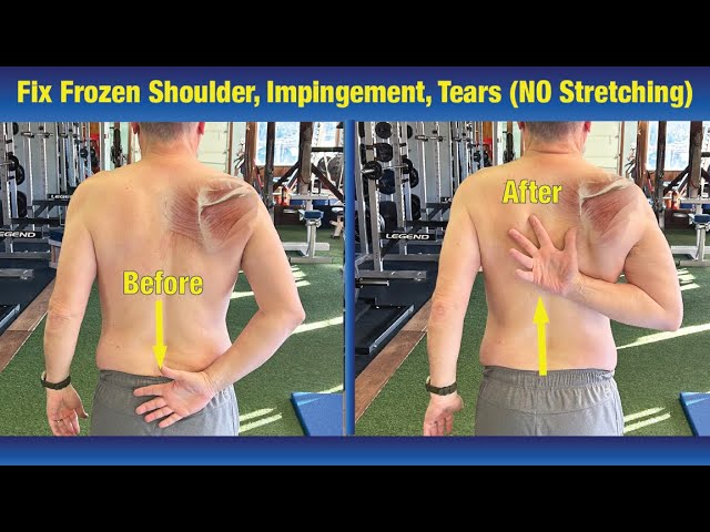 Beginner Shoulder Rehab Exercises for Scapular Stabilization and