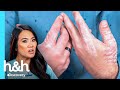 ¡No puedo lavar mis manos sin lastimarlas! | Dra. Sandra Lee: Especialista en piel | Discovery H&H