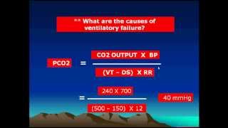 Arterial blood gases interpretation Respiratory acidosis 22/29(English)