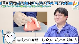 【歯肉出血を起こしやすい方への対応法】動画で学べる！今日から役立つ口腔ケア