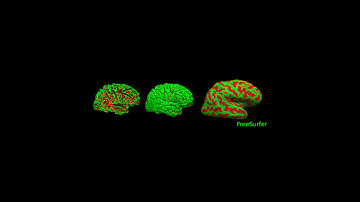 Freesurfer Course Live Stream