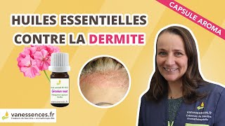 Huile Essentielle Dermite Séborrhéique Solution Naturelle Efficace