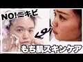 ニキビを治した♡もち肌スキンケア紹介