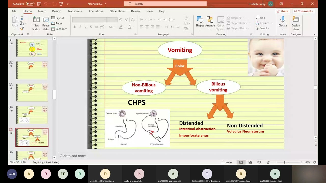محاضرة جراحة الاطفال Neonatal Surgery part 2 للفرقة الثالثه د/ إيهاب
