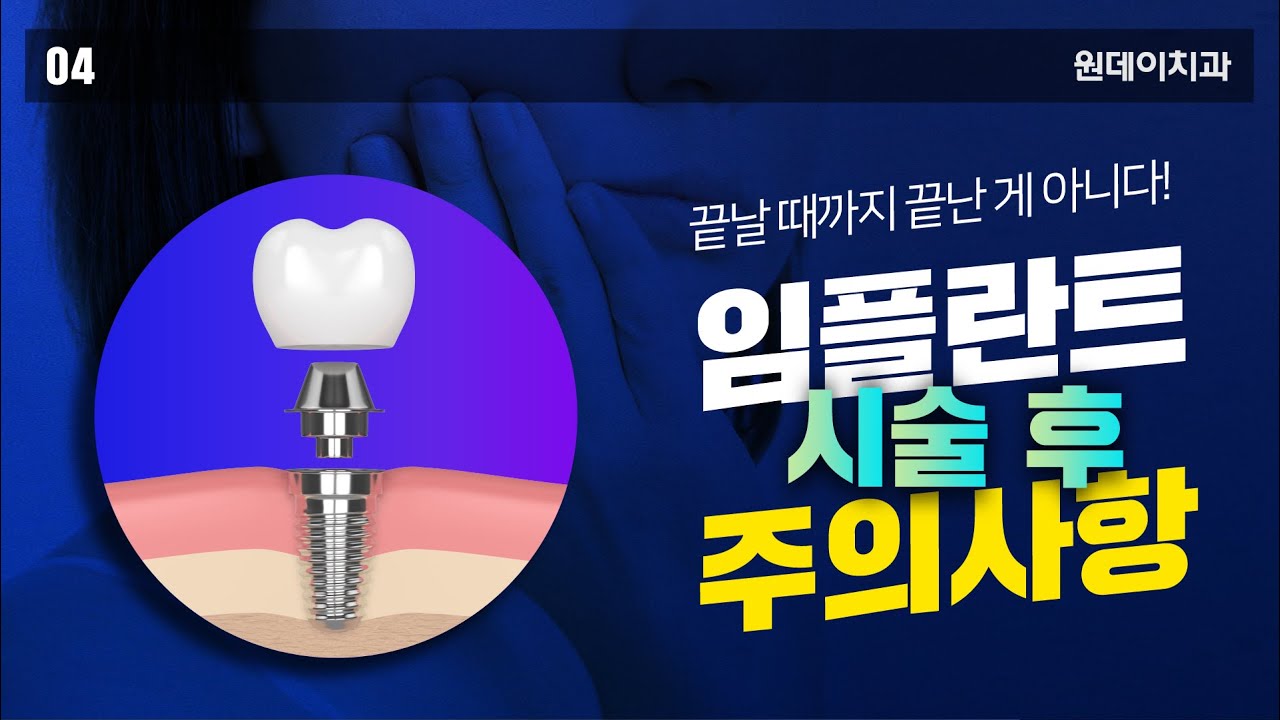 [一日牙醫診所] 植牙手術後注意事項！ -一日牙科