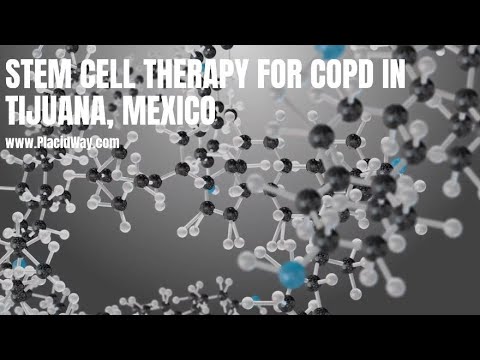The Stunning Power of Stem Cell Therapy for COPD in Tijuana Mexico ...